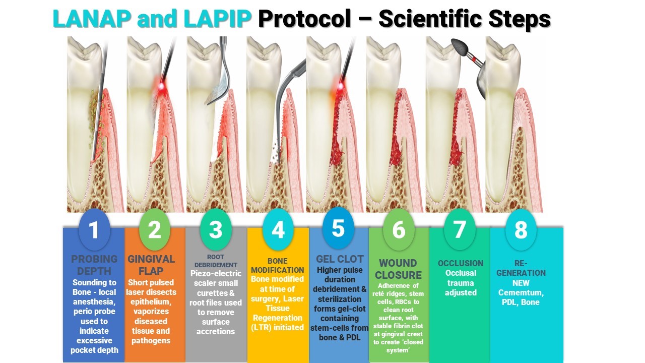 Laser Periodontal Therapy Parkway Periodontics