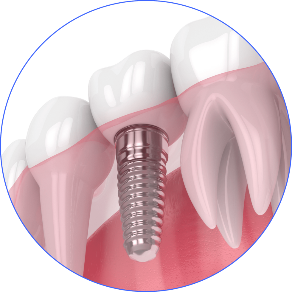 Parkway Periodontics Periodontist In Augusta GA Parkway periodontics periodontist in augusta ga